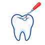 Tooth-Coloured Fillings