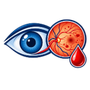 Diabetic Retinopathy Diagnosis & Treatment
